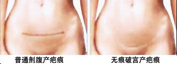 δ-1.jpg